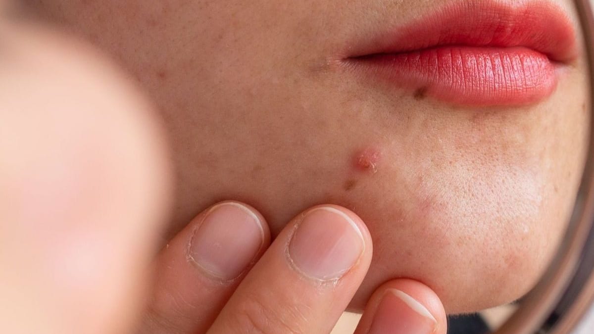Peur de mal faire sa routine de soin : Guide pour simplifier et protéger sa peau