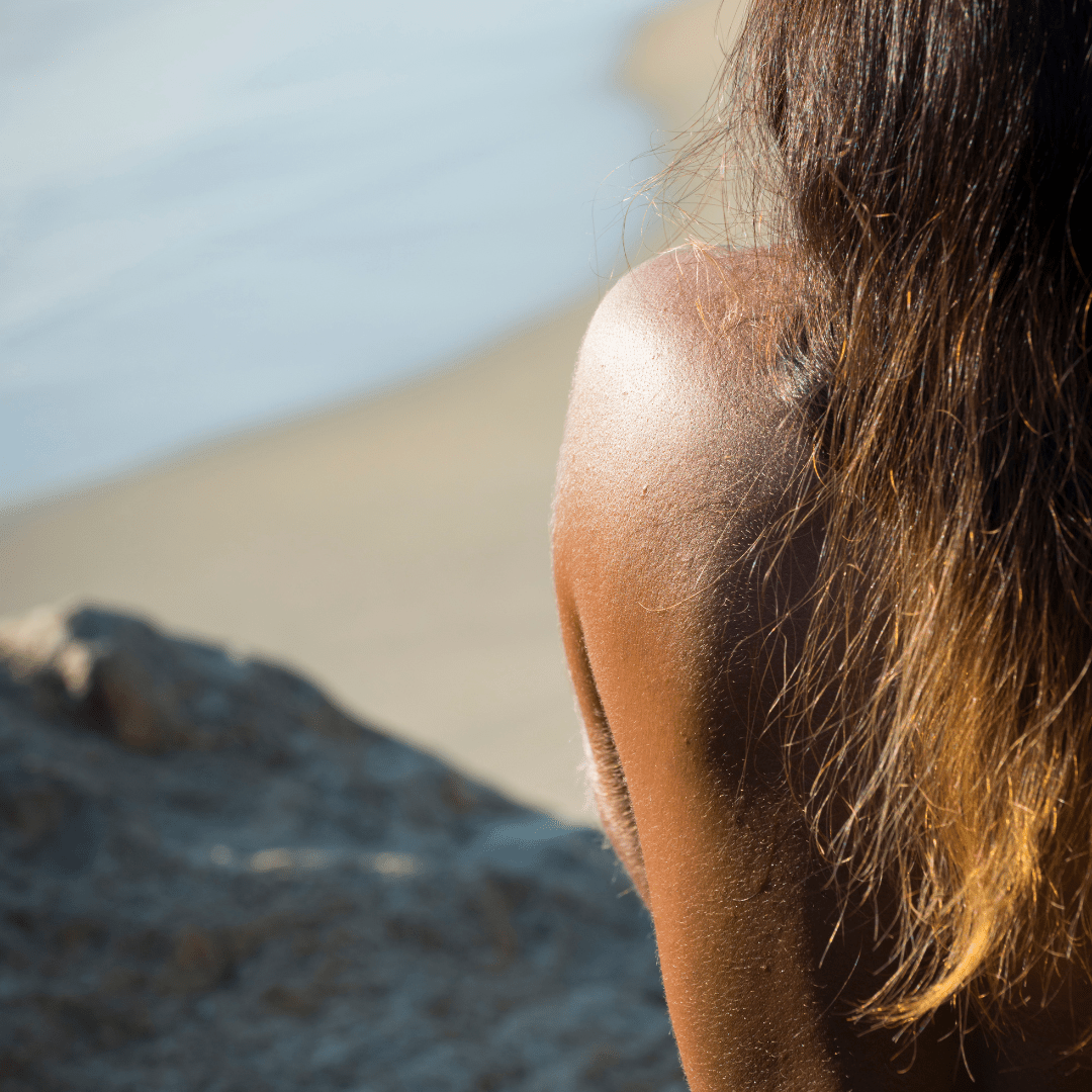 Dry Skin vs. Dehydrated Skin: Understanding the Key Differences for Better Skincare - Mono Skincare