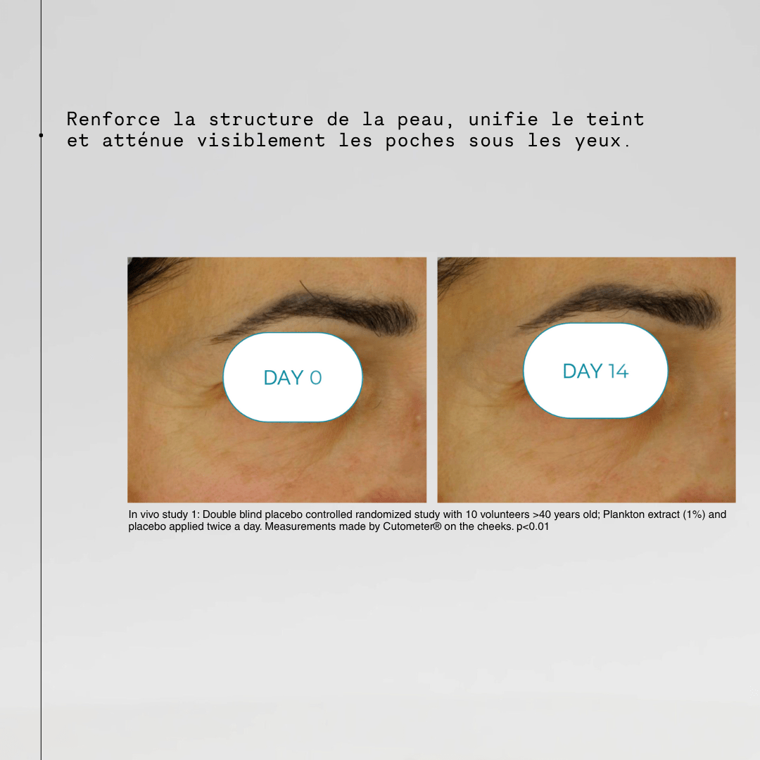 Invivo test before and after women eye patch
